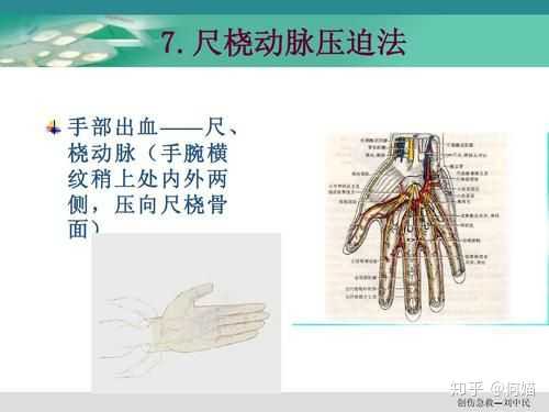 第三种,出血特别厉害前两种方法止不住的,按手腕两边大动脉