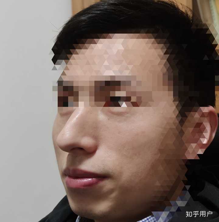 你们有见过鼻子太高的中国人吗,是不是太丑了,看到都吓到了?