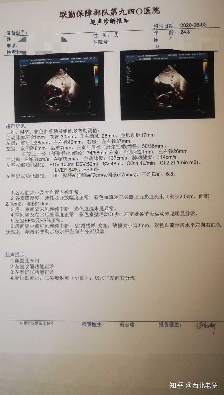 室性早搏,心脏彩超无异常,会对以后有影响吗,有什么注意事项啊?