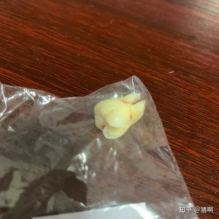 拔完智齿后那一周你经历了什么?