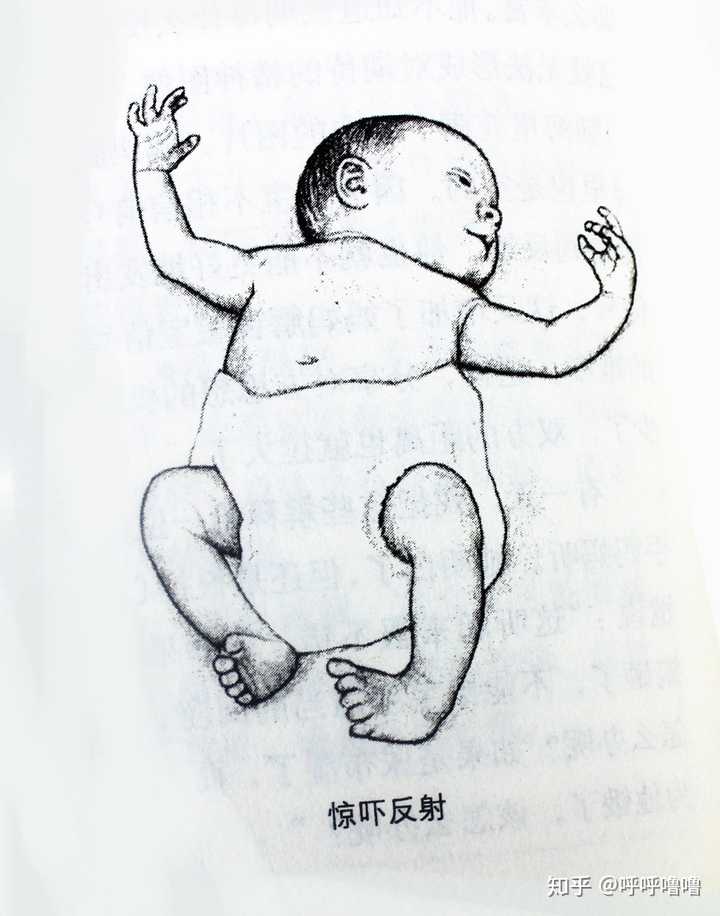 一个多月宝宝怎么吃奶后竖抱头一直往后仰?
