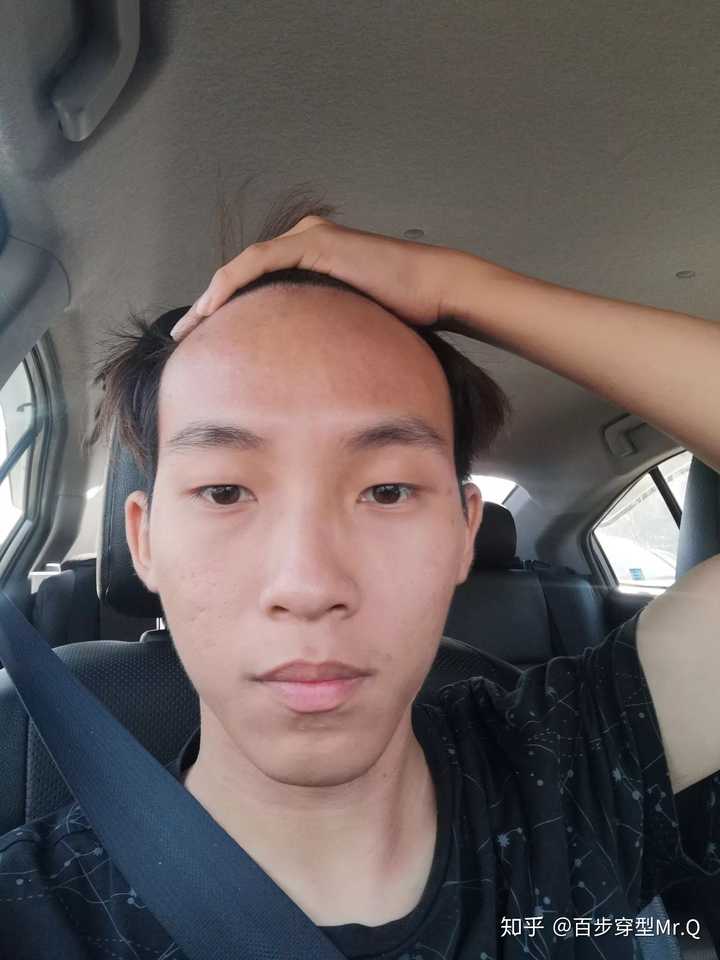 发际线很高的男人适合什么样的发型?