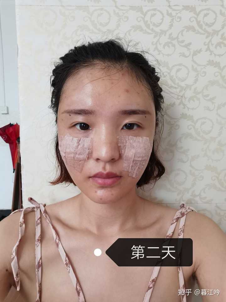 左右脸不对称 知乎