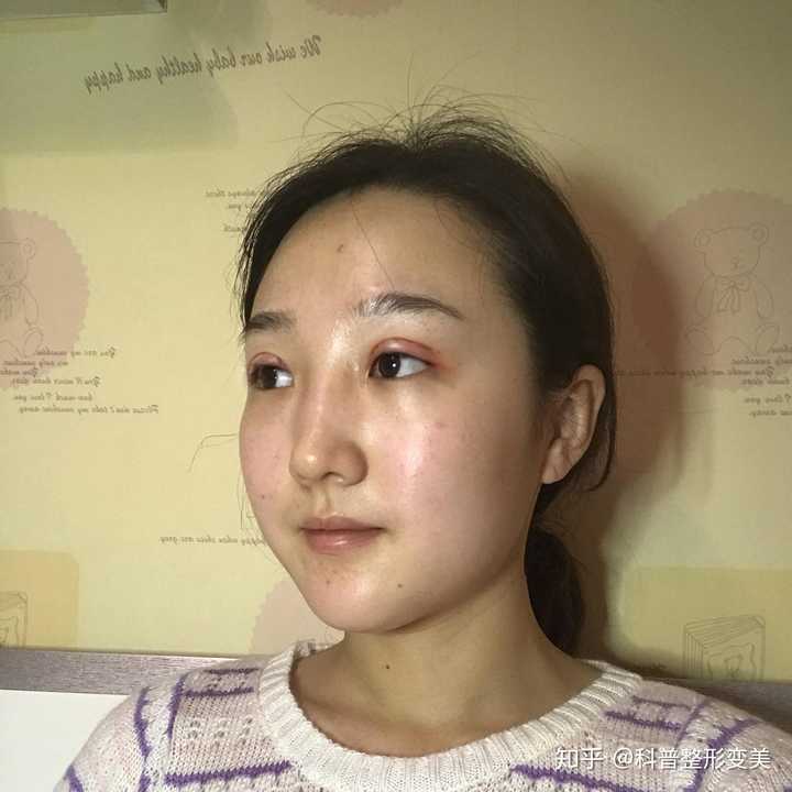 像安徽合肥有哪些好的整容医院?有哪些好的医生?