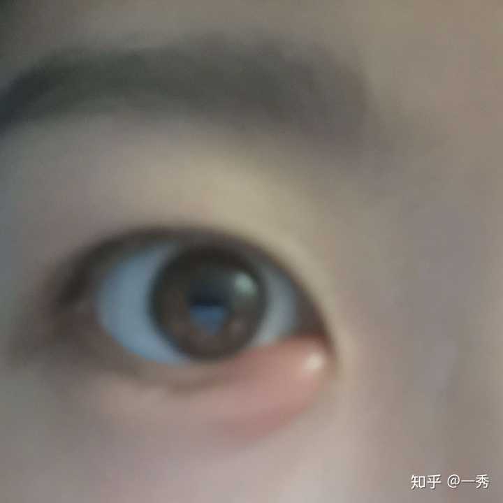 你们都是怎么治好的呢?