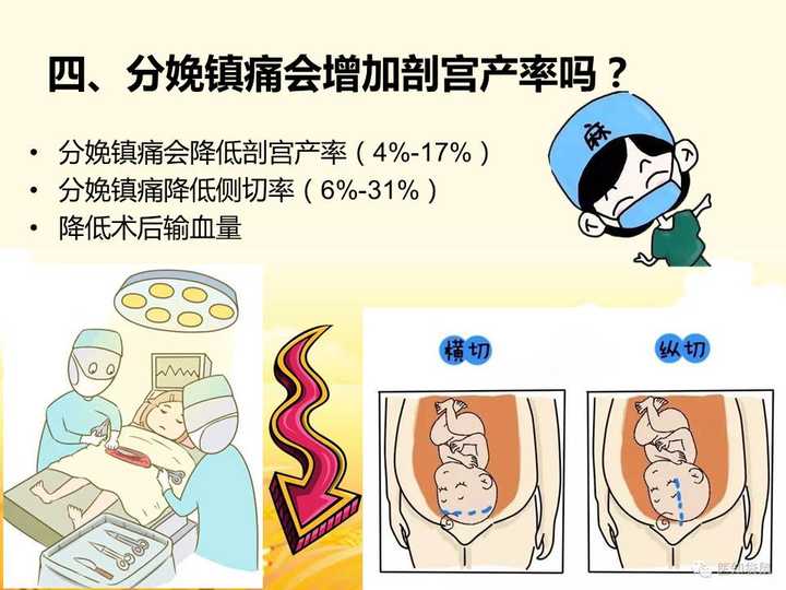 分娩镇痛小科普(版权所有)