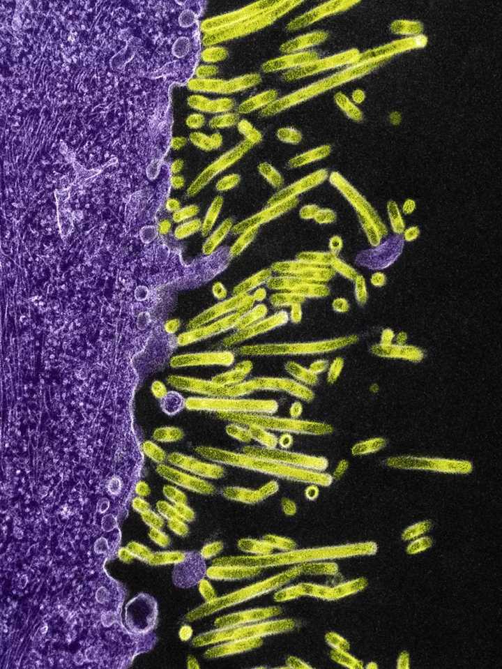 正从细胞表面出芽释放,黄绿色为病毒,透射电镜成像,图片源自@niaid