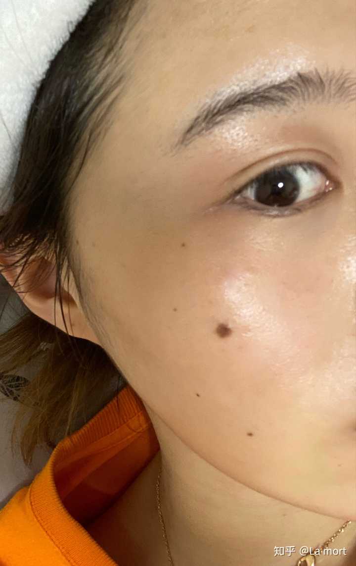 为什么有人说妖痣可怕,妖痣究竟长在哪里?