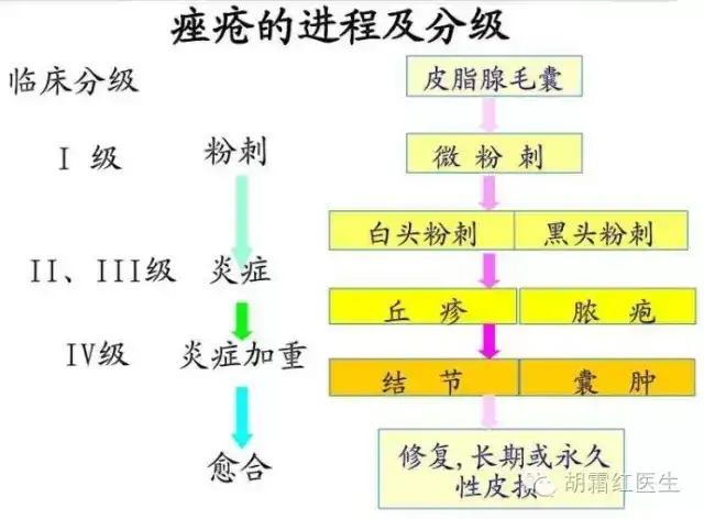 1,西医分类: (1)寻常性痤疮,发生于面部,胸背部:1)皮脂溢出;2)粉刺.