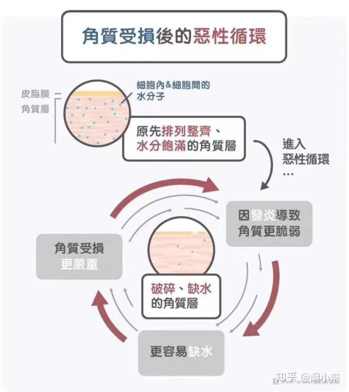 2)皮肤屏障受损会产生什么现象?