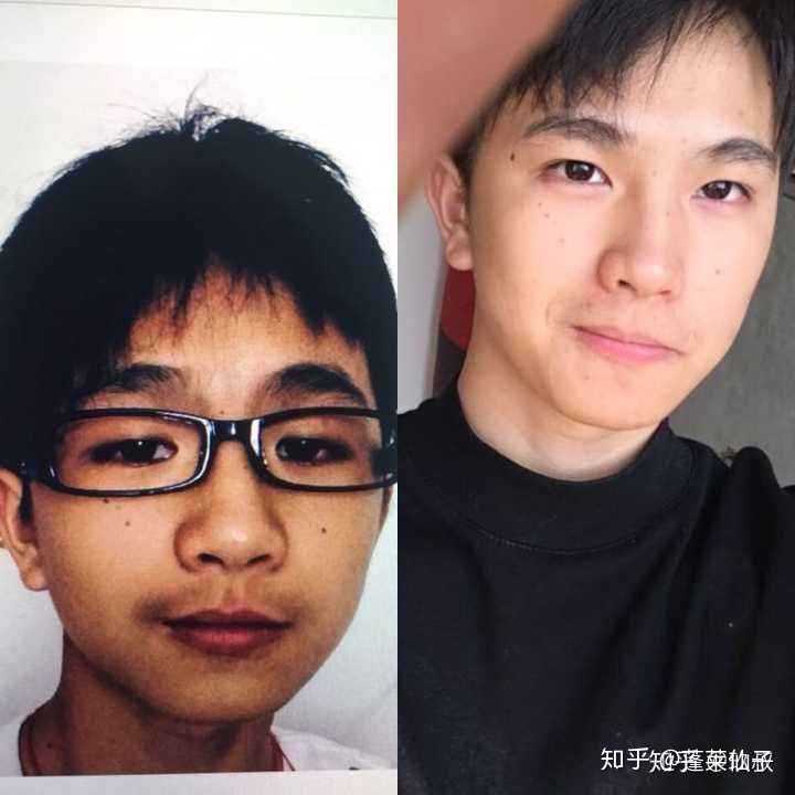 男生变白之后真的会比以前好看吗?