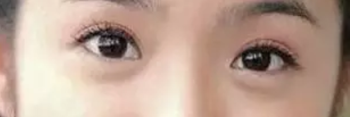 如何判断自己的眼型?