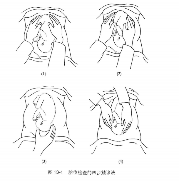 医生是怎么判断胎儿入盆的?