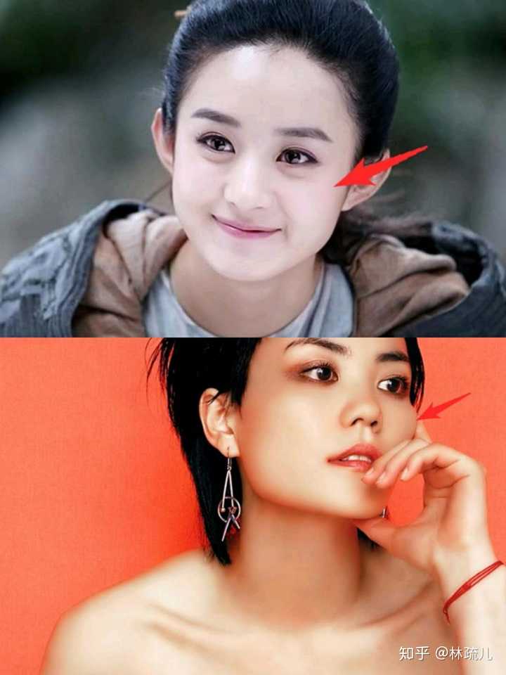 赵丽颖是没有明显的颧骨凸出的,王菲是有很明显的颧骨凸出的.