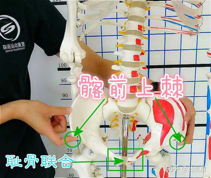 举个栗子:假如我们的髂前上棘左边高右边低