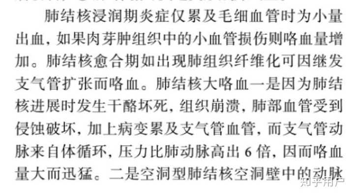 《咯血诊治专家共识》中对于肺结核咯血机制的分析