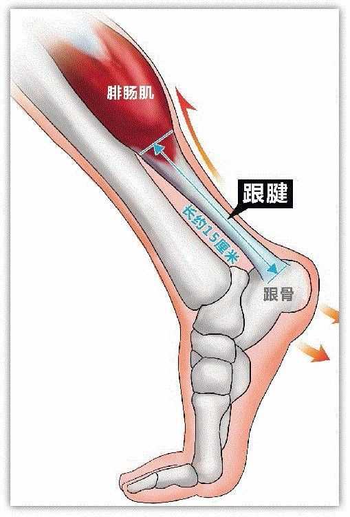 跟腱,又称为阿基里斯腱(源于希腊神话中的"阿基里斯之踵"),是位于