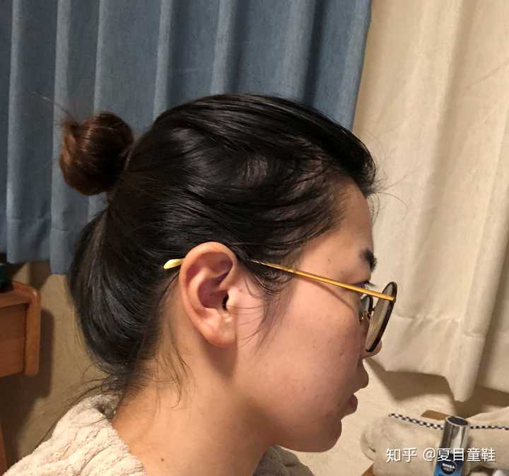 女生头顶头发少是什么体验 ?