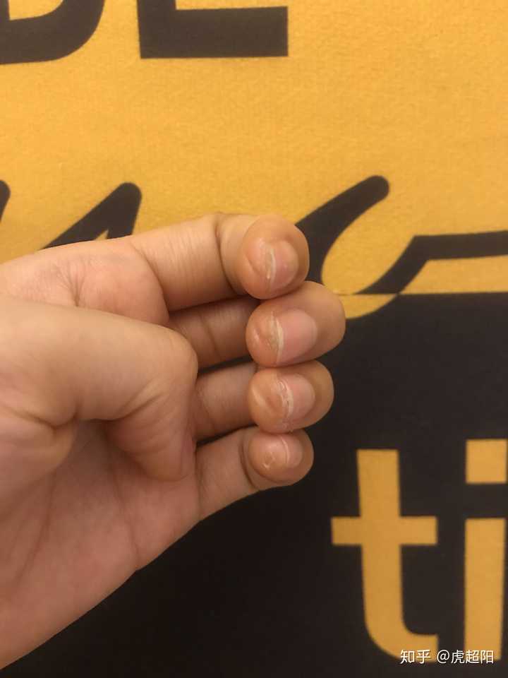 你弹吉他的手指已经变成什么样了?