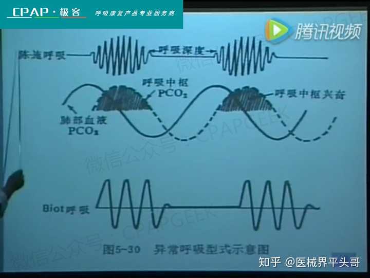 毛细血管通透性上升 (3)交感-肾上腺髓质兴奋性上升 2,中枢性呼吸衰竭