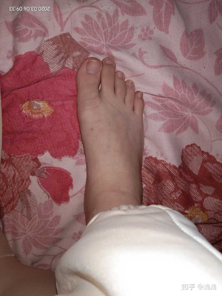 脚歪  