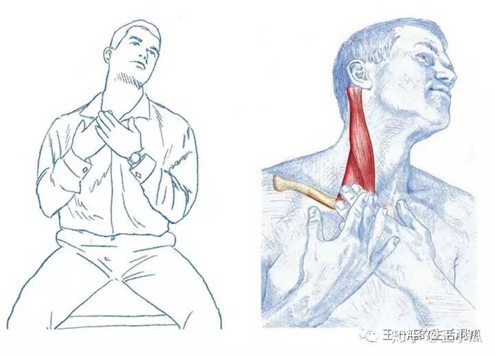 用手找到胸锁乳突肌肌腱,顺着肌肉方向向后拉伸,防止缩短.