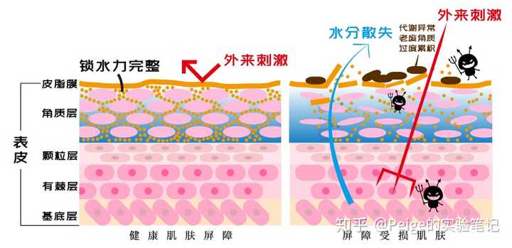 其实角质层受损,就是我们常说的皮肤屏障受损.