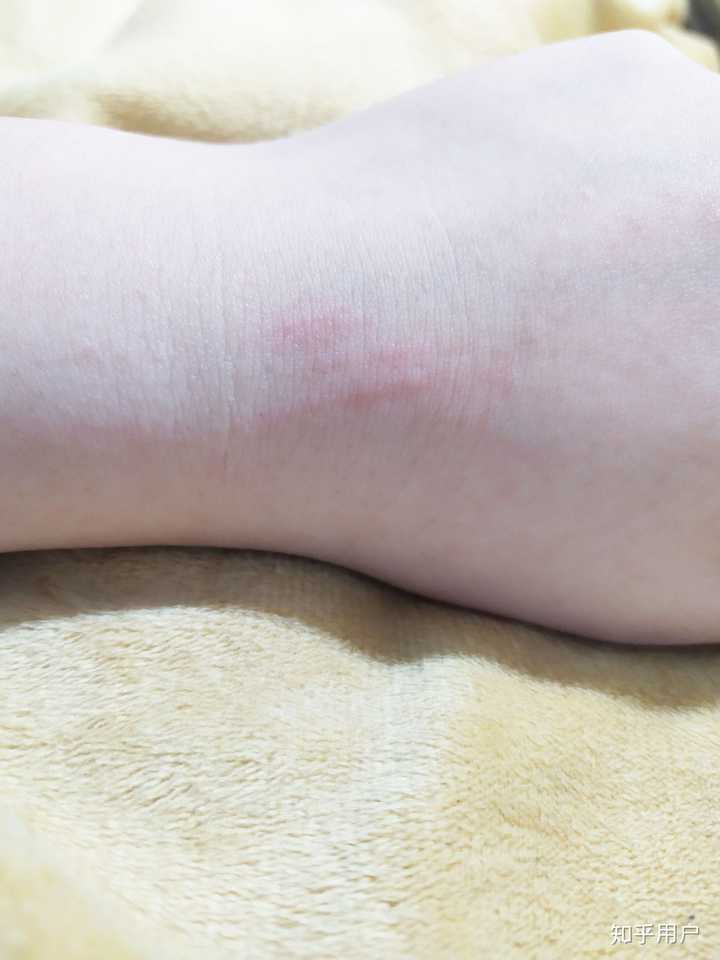 你们养猫以后都给自己打了狂犬疫苗吗