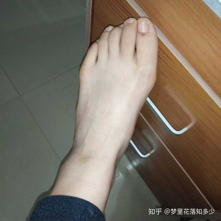 女生脚板大,又长夏天穿什么鞋?