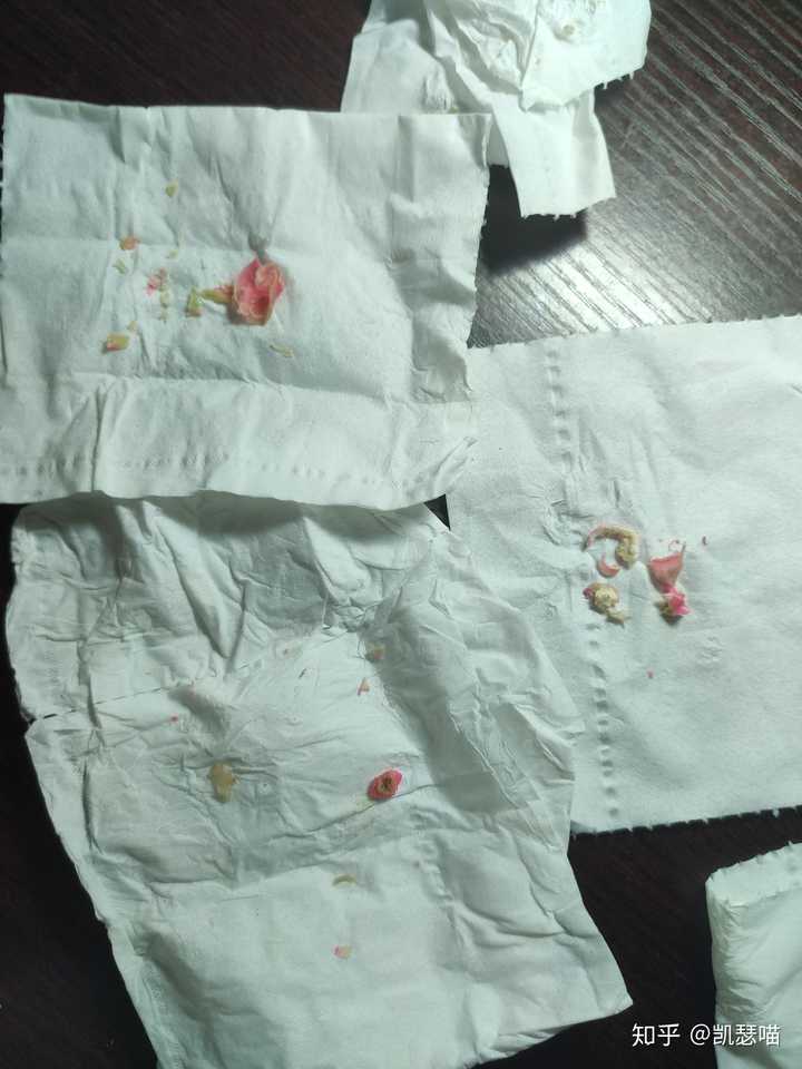 鸡眼怎么彻底挖出?