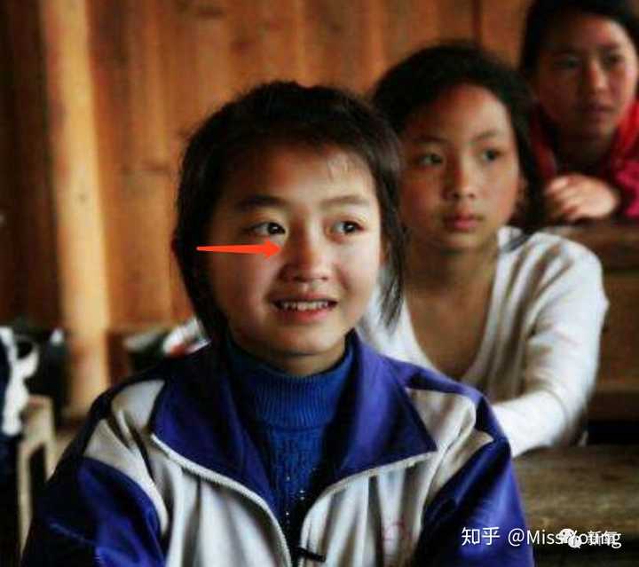 再仔细看她小时候的照片,找对了角度和光线也是能看出鼻子并没有想象