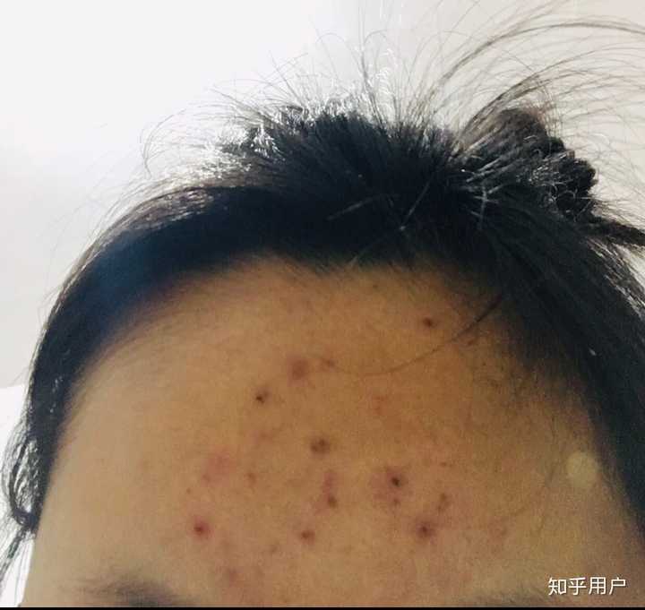 针清后 图三