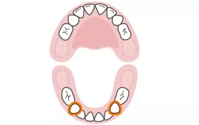 宝宝长牙顺序图&宝宝换牙顺序图?
