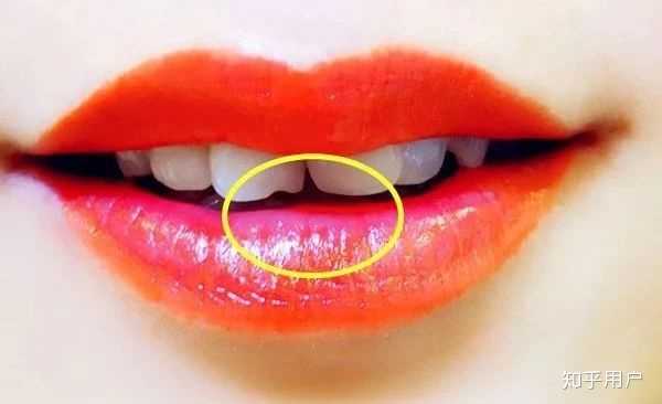 用后槽牙嗑瓜子,对牙的伤害大吗?