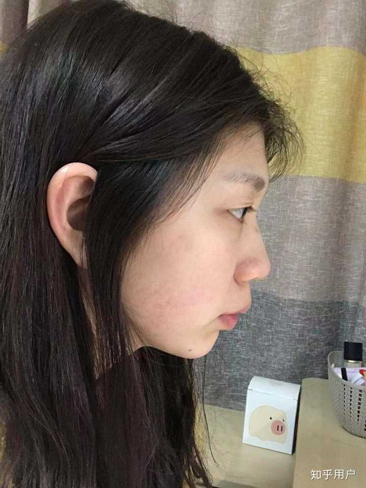 侧脸丑而正脸好看是一种什么体验?