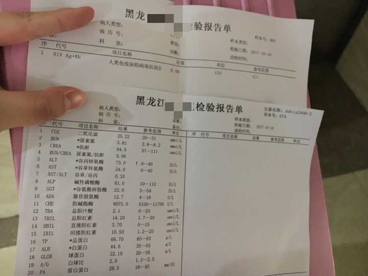 中国的艾滋病患者是否多,为什么?