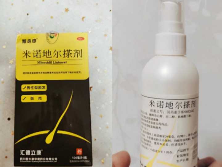 有清楚米诺地尔的还