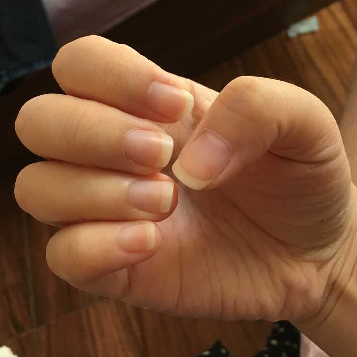 啃的惨不忍睹,感觉手指头都短了一节,照相也都避免拍到指甲,也不敢亮