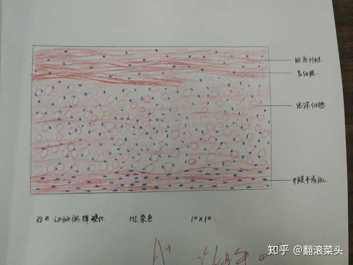 为什么咱们不弄个病理红蓝手绘图的问题呢?