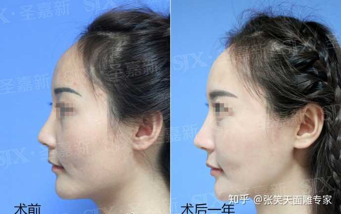 流畅的面部轮廓,但是颧骨太低反而会显得脸部扁平,适得其反