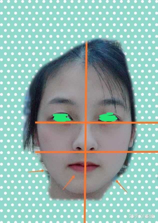 脸型极度不对称是什么体验?