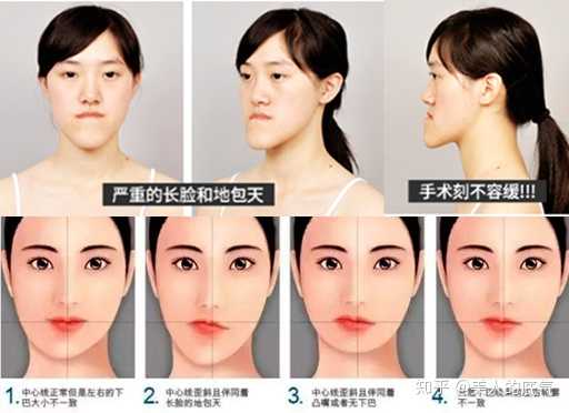 为什么亚洲人有很多凸嘴骨性和头骨或者牙型的差异有关么有没有大佬能