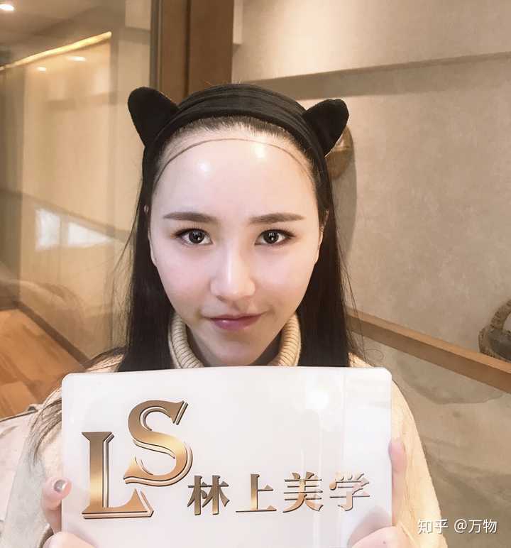 20岁发际线后移呈m型怎么办?
