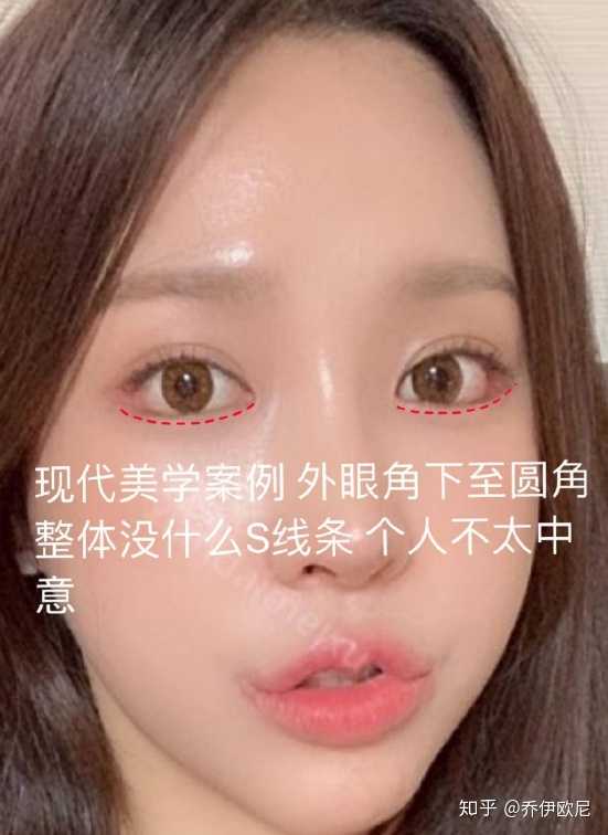 注意看下面的网红漂亮妹妹们的眼睛———— 她们的双眼皮都很窄