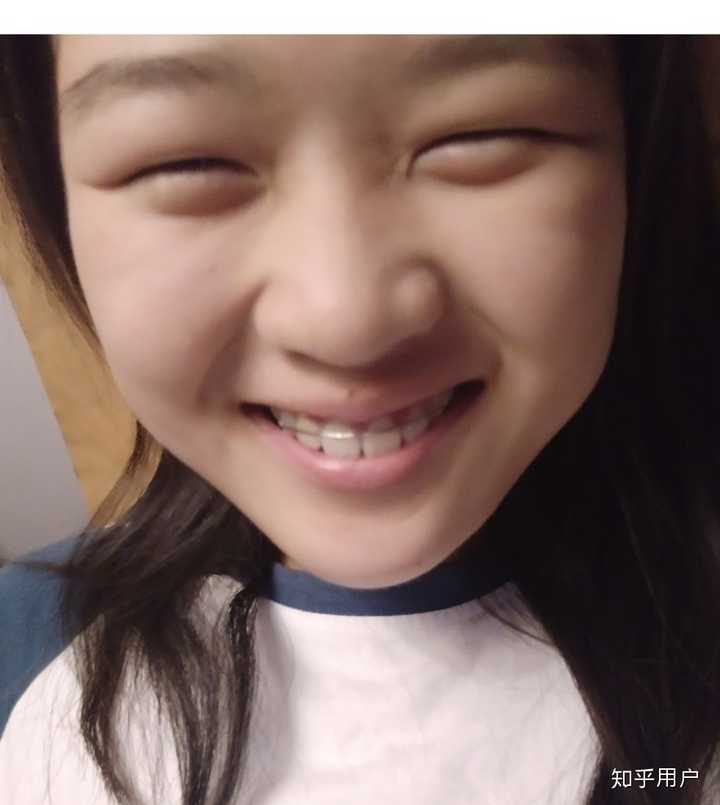 傻笑  