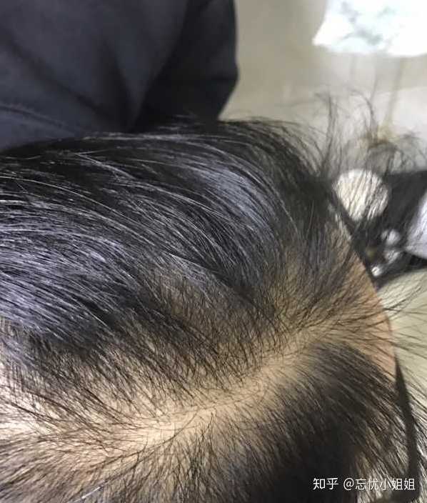 本来我要发朋友圈呢,看完男朋友拍的照片,还发什么朋友圈,都快气死了