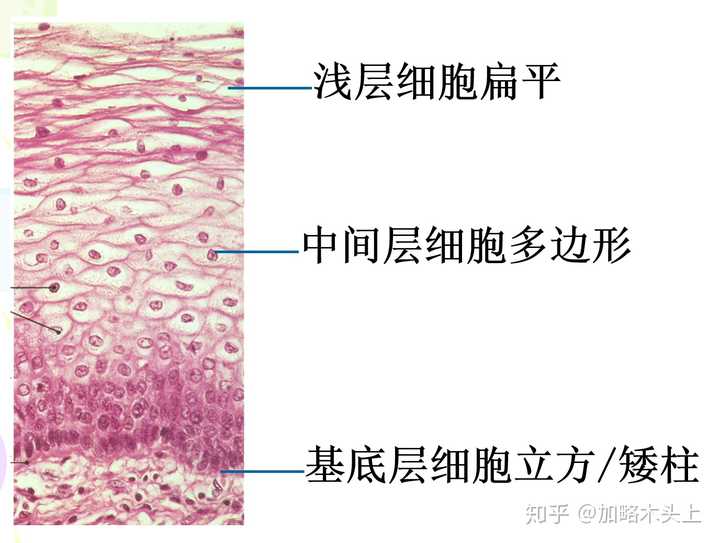 复层扁平上皮,真的很多层哦