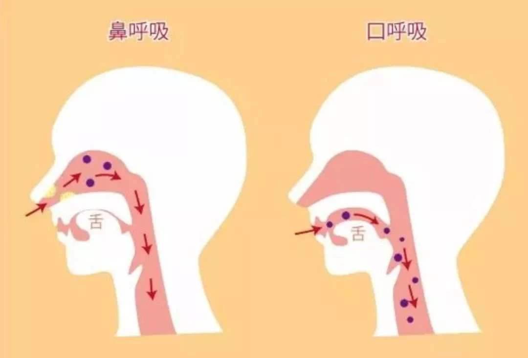 「口呼吸」对健康与面容有何影响,如何科学预防与矫正