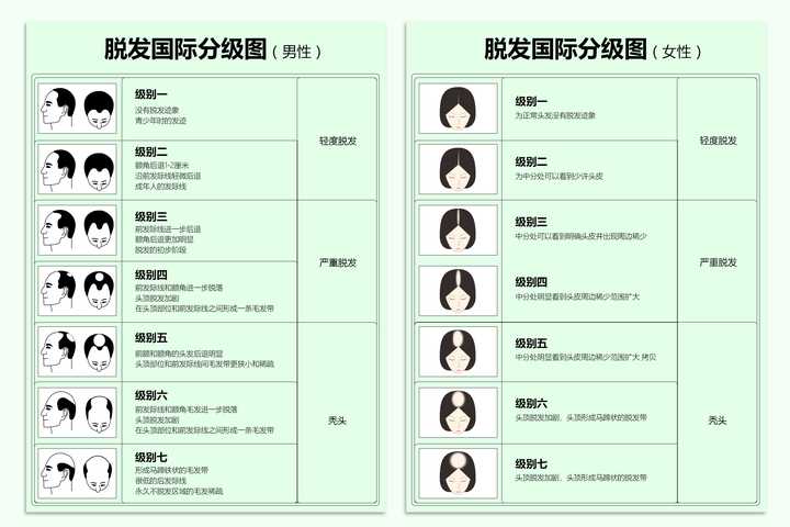 脱发国际分级图(男,女)