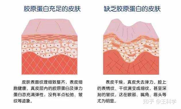 其实颈部皮肤表面的皮脂腺更少,更容易干燥,皮下脂肪和结缔组织也没有